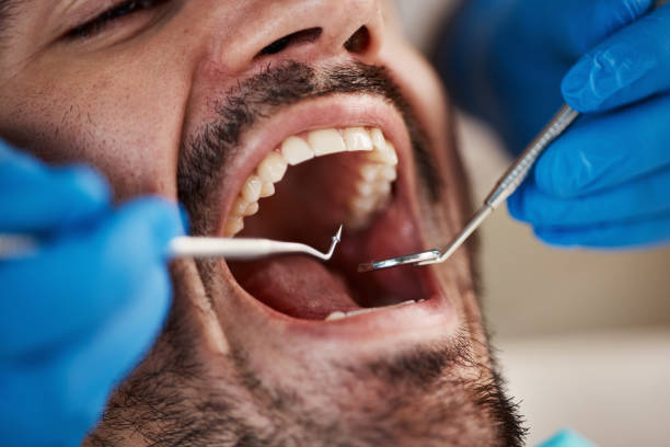 Best Emergency Treatment for Dental Infections or Abscesses in Bargersville, IN